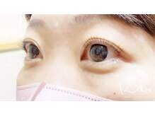 クレー(Klee)/パリジェンヌラッシュリフト