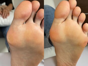 キラネイル アンド アイラッシュ by World Beauty(KIRA)/#新潟フットケア