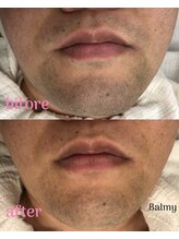 バルミー(Balmy)/毛が柔らかくなった！