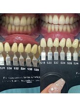 トウキョウスワーズ 池袋店(TOKYO SWRS)/#ホワイトニング #池袋 #渋谷