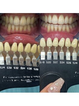 トウキョウスワーズ 池袋店(TOKYO SWRS)/#ホワイトニング #池袋 #渋谷