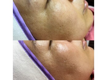 コモドアイラッシュ(comodo eyelash)/マリムーブフェイシャルワックス