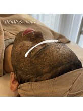 エヌボーテ(n beaute)/HERMOSA/ハーブピーリング