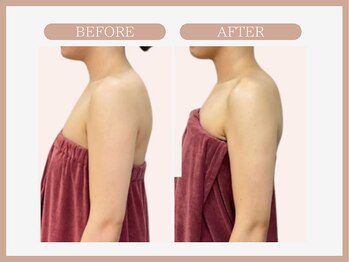 スリムライン 盛岡店(The Slim Line)/before→after