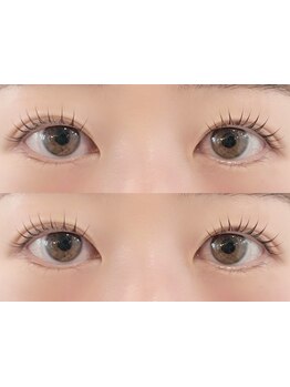 まつげのお悩み解決サロン