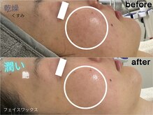 ルーナ 恵比寿(Luna)