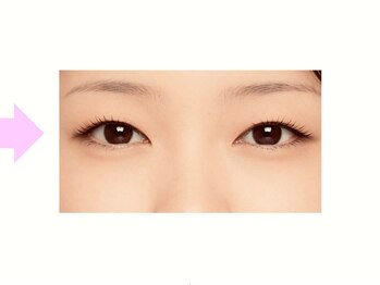 クロム アイプラス 狭山 入曽店(CHROM eye+)/腫れぼったく眠たげなまぶたに！