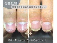リネイル 川越(Re:NAIL)の雰囲気（深爪で悩まれてる男性のご来店も増えています。）