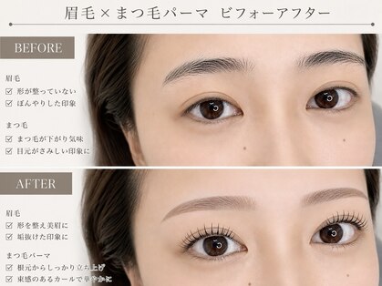 アイビューティー ロキエ 天王寺店(ROCHIE)の写真