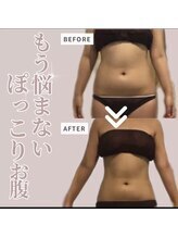 ソワン 小岩店(Soin)/ 30代　上半身