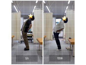 ナオル整体 飯田橋院(NAORU整体)/Before After/飯田橋/整体・矯正