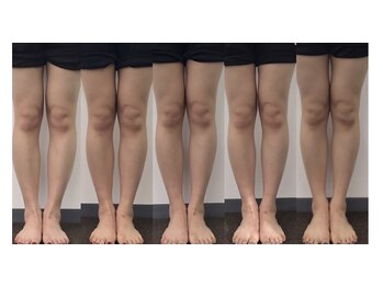 ツバキ(TSUBAKI)/捻れを除くと脚は細くなる！