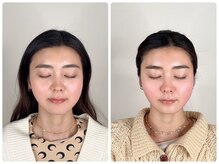 ベルガ 表参道店(Bellega)/