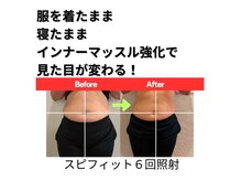 リフィール 国分寺店の雰囲気（電磁パルスEMSだけでサイズダウンも可能です。【痩身/骨盤矯正】）