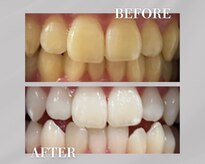 ホワイトニングショップ 銀座7丁目店(WHITENING SHOP)