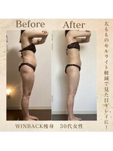 エソール(essor)/脚スッキリ♪