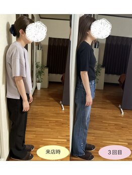 ディライト(D-LIGHT)/ブライダルに向けて☆姿勢矯正