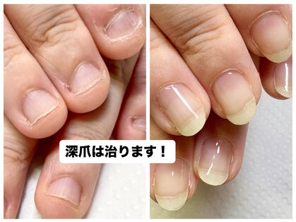 ネイルフレーバー(Nail Fravor)の写真