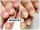 ネイルフレーバー(Nail Fravor)の写真