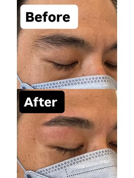 マグ 横浜店(Mag)/Wax脱毛