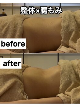 アンドリードット 堀江(&re.)/ガス溜まり方