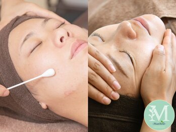 マーベル(MaaBelle)/エクスビアンス水光肌ピーリング