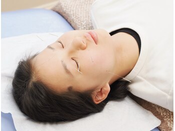 すがはら鍼灸院/痛みの少ない細鍼