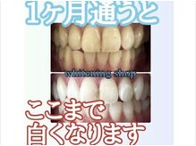 ホワイトニングショップ 亀岡店/1番安く長く通えるプラン！