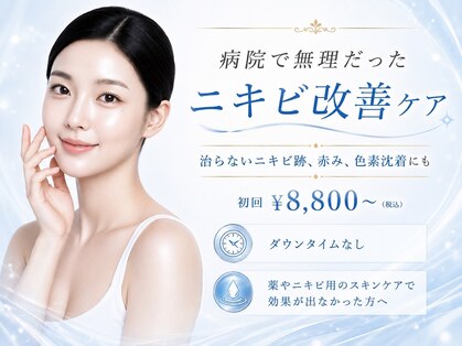 シャルナ(charna)の写真