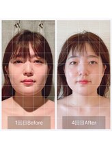 ジェミニ(Gemini)/理想のペースで理想の小顔に♪