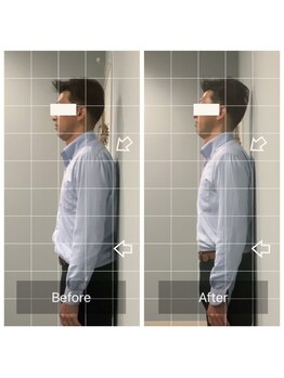 カドル(cuddle)/PARAFUSE.式ドライヘッドスパ