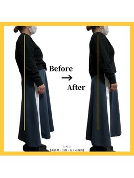 美容整体 レモン/反り腰改善