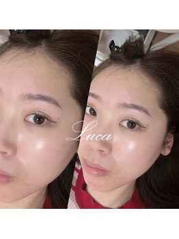 ルーカ(Luca)/眉パーマ【KANAU】