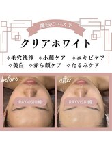 ブライダルにも☆クリアホワイト