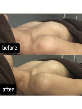 ヴィノ アイサロン(VINNO eyesalon)/お客様ビフォーアフター