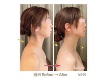 花音の雰囲気（ケア前には岩盤浴ドームがセットでホルミシス効果も得られます♪）