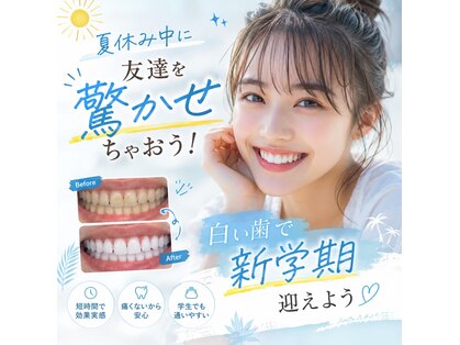 ホワイトニングショップ 香川丸亀店の写真