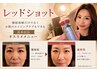 【韓国肌管理/水光肌】脂肪分解レッドショット+高濃度ヒト幹細胞導入  9900円