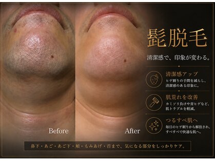 トノ(TONO)の写真