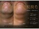 トノ(TONO)の写真