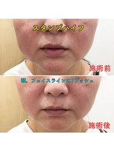 みつばちさろん/【ブラックスタンプ】顔