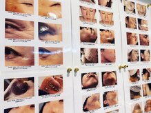 オアシスラグーン(OASIS LAGOON)/Skinformation 