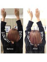 ナオル整体 国分寺院(NAORU整体)/20代女性　【肩の痛み】