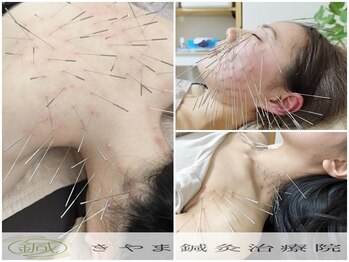 きやま鍼灸治療院