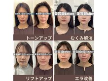 ハリサロンドオフ 堺東店(hari salon de off)