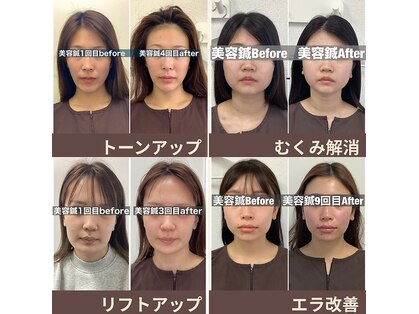 ハリサロンドオフ 堺東店(hari salon de off)の写真