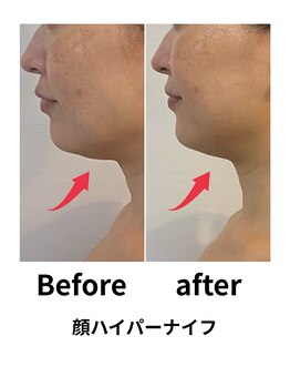 ビービー(BB)/平日限定★