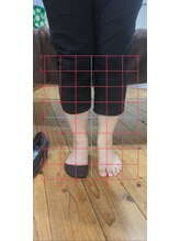 ソイル(Soile)/足の施術