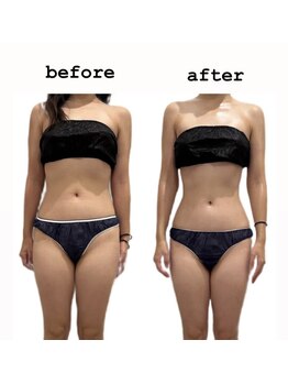 シャルム(CHARME)/痩身理論完結コース