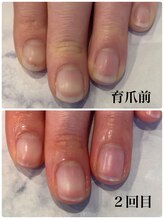 ネロリ(Neroli)/医療従事者でも育爪出来ます◎